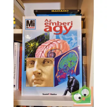 Monika Rößiger: Az emberi agy (Mi Micsoda 64.)