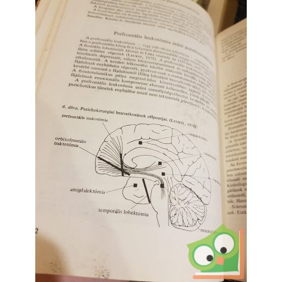 Péter Ágnes: Neurológia, neuropszichológia
